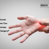 Physiotherapy for carpal tunnel syndrome